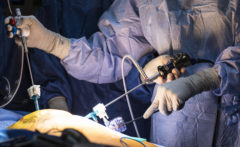 Surgery being performed with long instruments