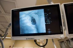 Surgery Monitor screen